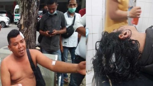 Korban penganiayaan dirawat di RSU F Tobing Sibolga. Foto: Istimewa.